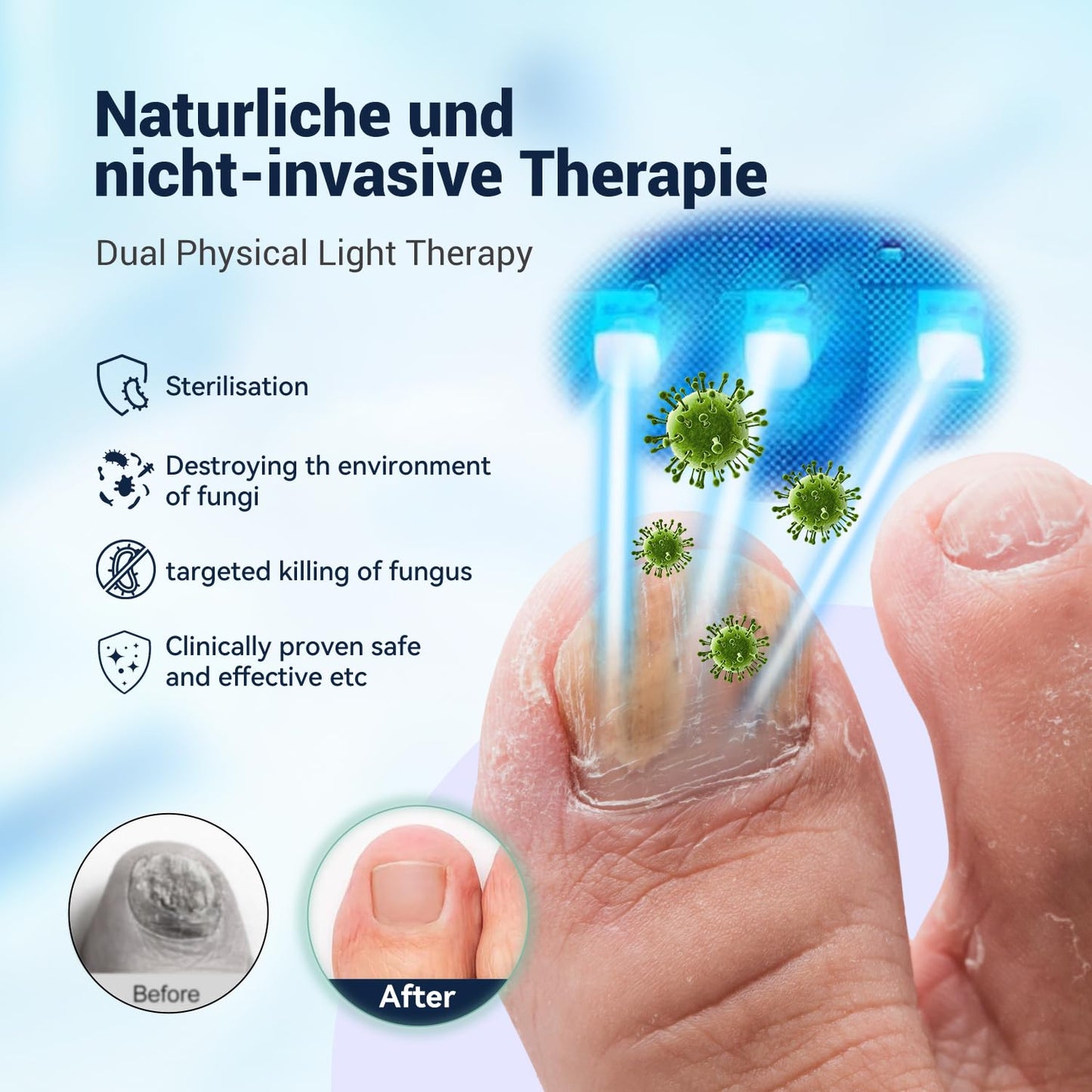 PureLite - Nagelpilz Lasertherapie